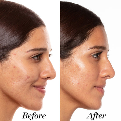 Before and after image of female who used A+ for 6 weeks